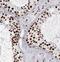 Protein O-Glucosyltransferase 3 antibody, FNab04507, FineTest, Immunohistochemistry paraffin image 