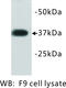 Developmental Pluripotency Associated 2 antibody, MBS355092, MyBioSource, Western Blot image 