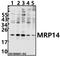S100 Calcium Binding Protein A9 antibody, M00380-3, Boster Biological Technology, Western Blot image 