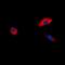 B1AR antibody, LS-C368864, Lifespan Biosciences, Immunofluorescence image 