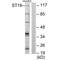 ST18 C2H2C-Type Zinc Finger Transcription Factor antibody, A10267, Boster Biological Technology, Western Blot image 
