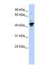 RBMX Like 2 antibody, NBP1-57164, Novus Biologicals, Western Blot image 