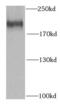 Histone-lysine N-methyltransferase SETDB1 antibody, FNab07771, FineTest, Western Blot image 