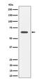 SOCS7 antibody, M06055, Boster Biological Technology, Western Blot image 