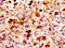 Mannan Binding Lectin Serine Peptidase 2 antibody, LS-C672586, Lifespan Biosciences, Immunohistochemistry paraffin image 