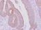 Keratin 71 antibody, NBP2-17040, Novus Biologicals, Immunohistochemistry paraffin image 