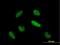 TIA1 Cytotoxic Granule Associated RNA Binding Protein Like 1 antibody, H00007073-B01P, Novus Biologicals, Immunocytochemistry image 