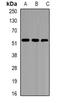 Epoxide Hydrolase 1 antibody, orb340819, Biorbyt, Western Blot image 