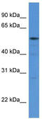 Histidyl-TRNA Synthetase antibody, TA343149, Origene, Western Blot image 