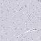Charcot-Leyden Crystal Galectin antibody, PA5-59708, Invitrogen Antibodies, Immunohistochemistry paraffin image 