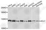 ATP Citrate Lyase antibody, A9901, ABclonal Technology, Western Blot image 