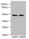 Chaperone SurA antibody, orb352185, Biorbyt, Western Blot image 