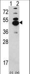 Calcium/calmodulin-dependent protein kinase type 1D antibody, LS-C168285, Lifespan Biosciences, Western Blot image 