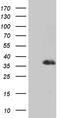 Distal-Less Homeobox 1 antibody, TA811632S, Origene, Western Blot image 