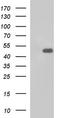 Protein Tob2 antibody, TA590255, Origene, Western Blot image 