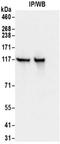 Kinesin Family Member 5B antibody, NBP2-32279, Novus Biologicals, Immunoprecipitation image 