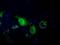 Pantothenate kinase 2, mitochondrial antibody, GTX83944, GeneTex, Immunofluorescence image 