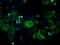 ATP Synthase F1 Subunit Beta antibody, GTX84849, GeneTex, Immunofluorescence image 