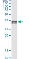 Serine Protease 8 antibody, LS-C198013, Lifespan Biosciences, Immunoprecipitation image 