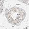Progesterone Receptor antibody, HPA004751, Atlas Antibodies, Immunohistochemistry paraffin image 