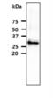 Fc Fragment Of IgG Receptor Ia antibody, NBP2-42685, Novus Biologicals, Western Blot image 