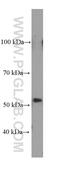 Carbonic Anhydrase 9 antibody, 66243-1-Ig, Proteintech Group, Western Blot image 