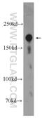 Ring Finger Protein 17 antibody, 24302-1-AP, Proteintech Group, Western Blot image 