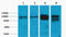 Vinculin antibody, STJ97117, St John