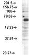 Calcium Voltage-Gated Channel Auxiliary Subunit Beta 4 antibody, orb67408, Biorbyt, Western Blot image 