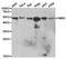 Hydroxymethylbilane Synthase antibody, TA327175, Origene, Western Blot image 