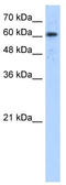 ADAM Metallopeptidase Domain 30 antibody, TA338474, Origene, Western Blot image 