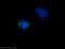 Centrosomal Protein 192 antibody, 18832-1-AP, Proteintech Group, Immunofluorescence image 