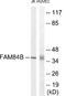 LRAT Domain Containing 2 antibody, EKC1902, Boster Biological Technology, Western Blot image 