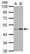 Coiled-Coil And C2 Domain Containing 2B antibody, NBP2-15738, Novus Biologicals, Western Blot image 