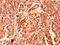 Ribosomal Protein S26 antibody, A63354-100, Epigentek, Immunohistochemistry paraffin image 