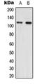Nicotinamide Nucleotide Transhydrogenase antibody, orb215559, Biorbyt, Western Blot image 