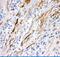 FAS antibody, PB9252, Boster Biological Technology, Immunohistochemistry paraffin image 