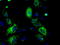 ATP Synthase F1 Subunit Beta antibody, TA500849, Origene, Immunofluorescence image 