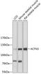 Actinin Alpha 3 (Gene/Pseudogene) antibody, 14-672, ProSci, Western Blot image 