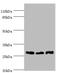 Guanidinoacetate N-Methyltransferase antibody, A54515-100, Epigentek, Western Blot image 