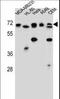 Acetylserotonin O-Methyltransferase Like antibody, LS-C156544, Lifespan Biosciences, Western Blot image 