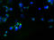 Rhomboid Like 2 antibody, A54699-100, Epigentek, Immunofluorescence image 