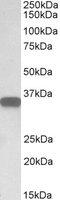 CD20 antibody, MBS421929, MyBioSource, Western Blot image 