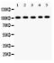 Solute Carrier Family 4 Member 1 (Diego Blood Group) antibody, PA5-80030, Invitrogen Antibodies, Western Blot image 