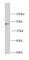 3-Phosphoinositide Dependent Protein Kinase 1 antibody, FNab06288, FineTest, Western Blot image 