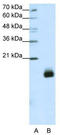 Ribosomal Protein S14 antibody, TA345748, Origene, Western Blot image 