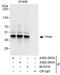 Ymer antibody, A302-093A, Bethyl Labs, Immunoprecipitation image 