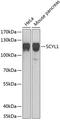 SCY1 Like Pseudokinase 1 antibody, GTX33489, GeneTex, Western Blot image 