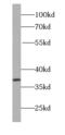 Nucleophosmin 1 antibody, FNab00760, FineTest, Western Blot image 