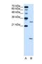 Vacuolar ATPase Assembly Factor VMA21 antibody, NBP1-59918, Novus Biologicals, Western Blot image 